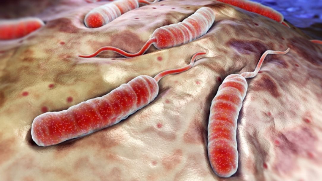 A magnified image of the cholera virus