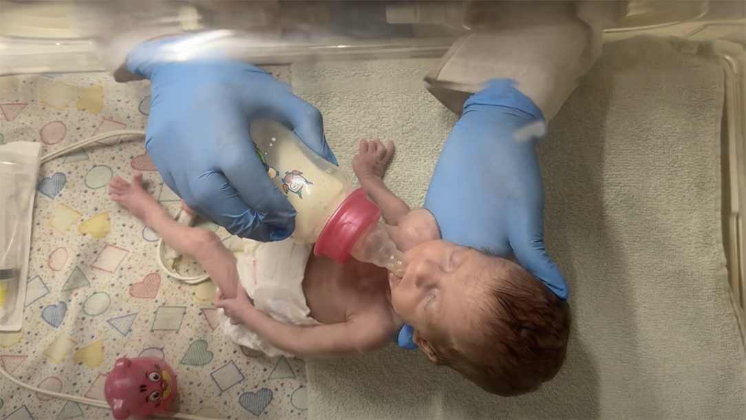 A severely malnourished baby lying in a hospital bed drinks from a bottle held by a pair hands wearing surgical gloves.